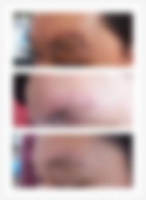 八、广州佳和医院血管瘤科真实的患者评价