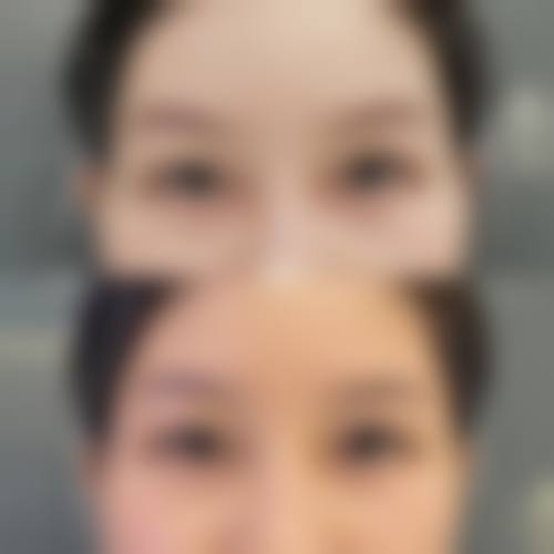 九、南京德美整形医疗美容门诊部真实的患者评价