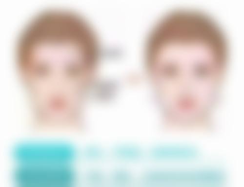 二、割双眼皮留下的疤痕去除方法