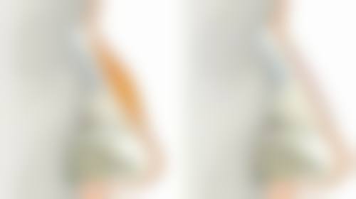 四、提眉术后疤痕修复的注意事项