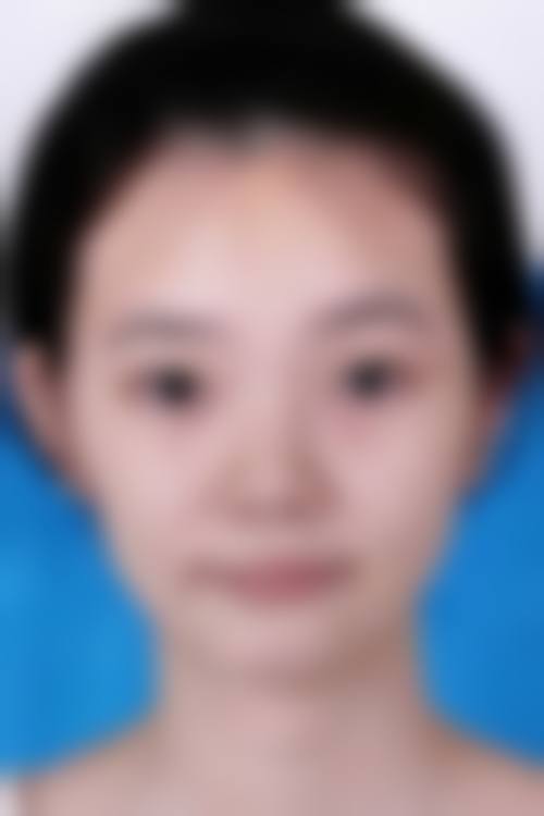 九、重庆莱森植发门诊部真实的患者评价