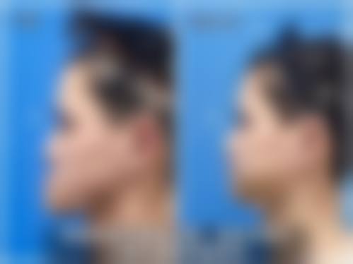 七、南通赫本整形医院预约方式