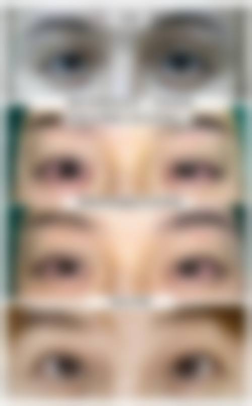 六、广州蛋壳肌因伊格医疗美容门诊部价格表