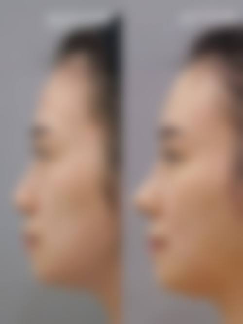 三、邵阳婉媄医疗美容门诊诊疗项目有哪些?