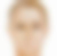 双眼皮手术后怎么不一样大？探究原因及能否恢复正常的关键要点 