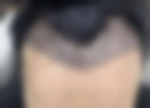 五、章德农怎么预约?
