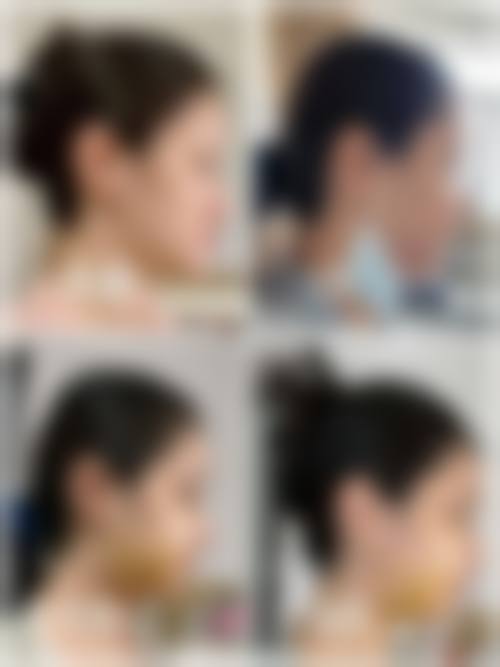 八、海口中龄整形医院真实的患者评价
