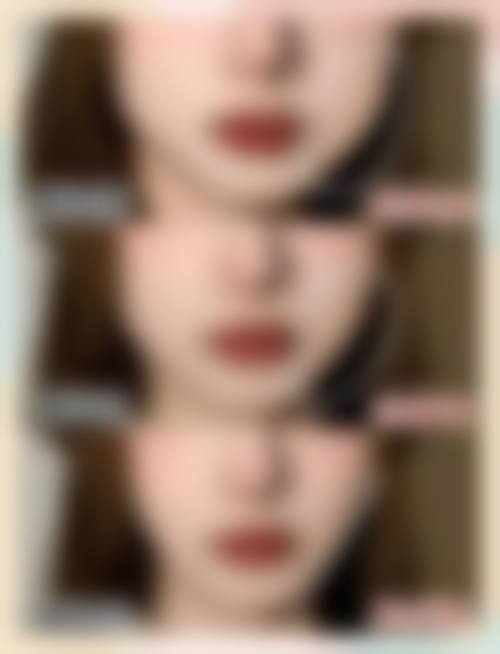 四、开封影子医疗美容诊所特色项目
