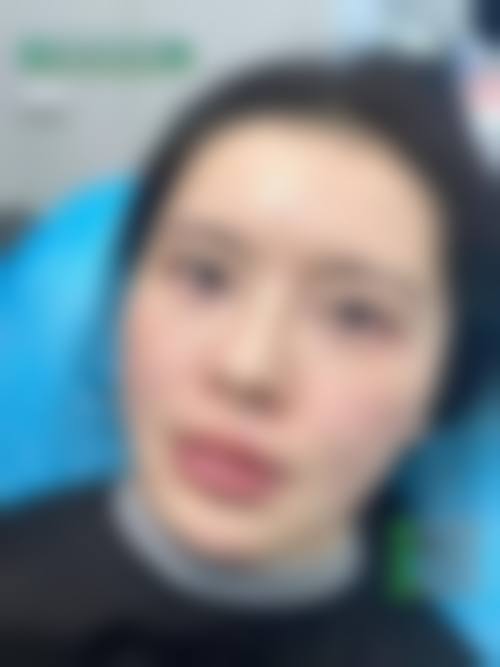 六、济南华夏医院激光美容科价格表