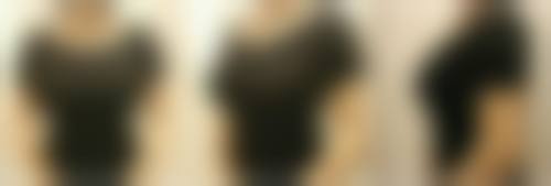 三、宝鸡协和医院整形美容中 心诊疗项目有哪些?