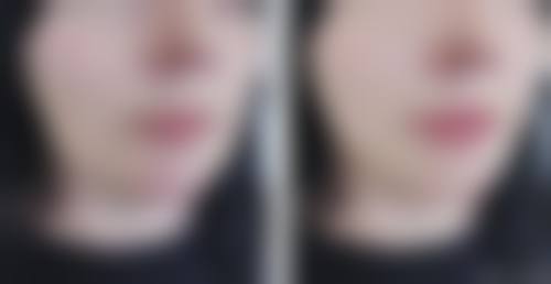 二、山东青岛佳蒂医疗美容怎么样?