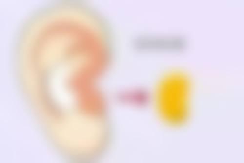 三、凹进去的疤痕的治疗方法