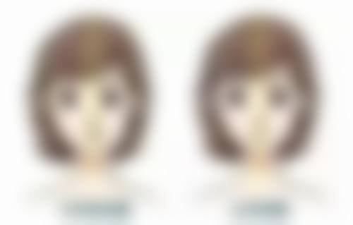 一、凹进去的疤痕形成的常见原因