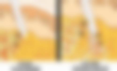四、割双眼皮后修复快之其他注意细节