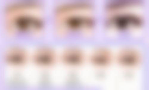 五、选择合适的治疗方法