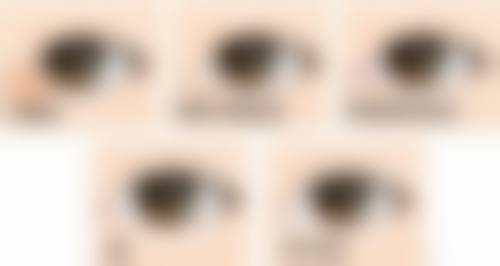 一、没有眼袋怎么泪沟会形成？