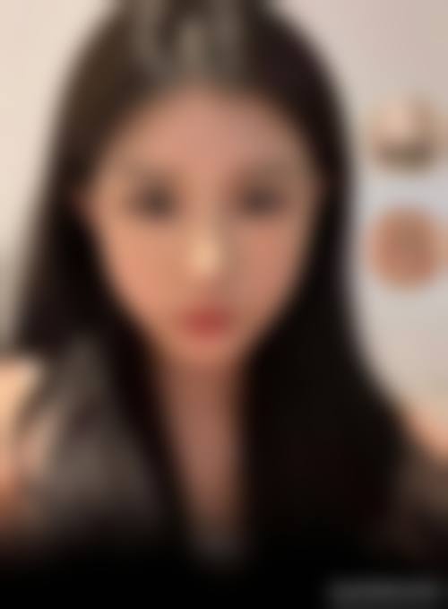 九、广州市人民医院整形美容科真实的患者评价