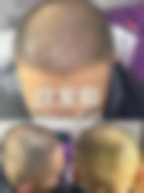 九、呼和浩特王冀贤医疗美容诊所真实的患者评价