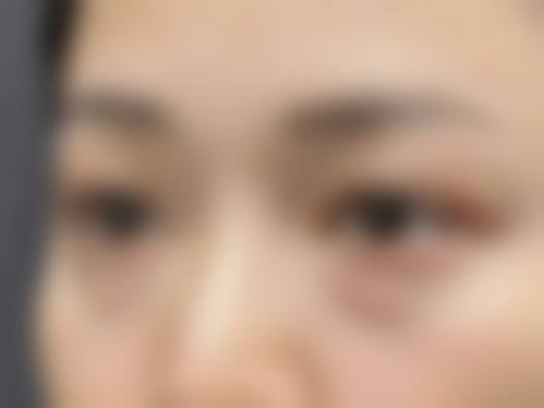 九、重庆伊恒妍医疗美容门诊部真实的患者评价
