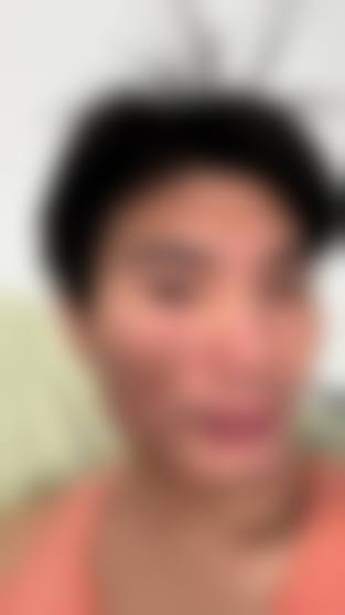 四、广州市人民医院整形美容科特色项目