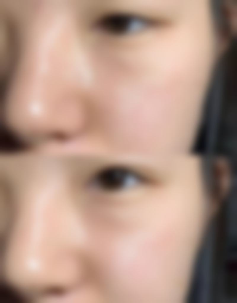 九、洪山德美医疗美容门诊部真实的患者评价