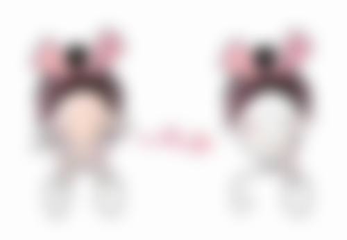 四、如何降低自身填充脂肪隆胸的风险