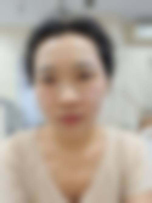 四、连云港徐杨美容整形医院特色项目