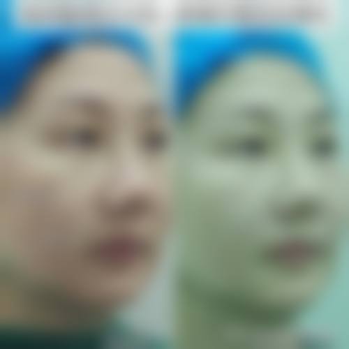 三、平顶山艺美医院美容医院诊疗项目有哪些？