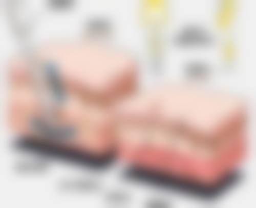四、中山禾佳医疗美容特色项目