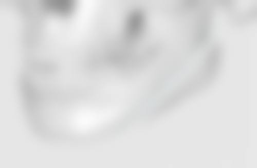 四、肋软骨隆鼻术其他可能的后遗症