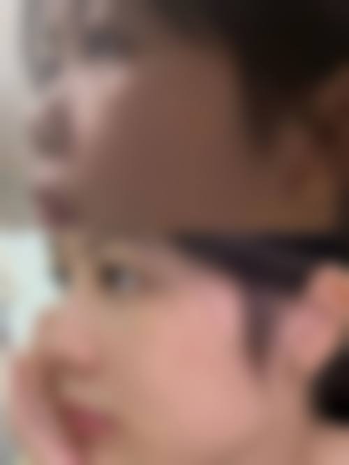 八、韩国Merry整形外科医院预约方式