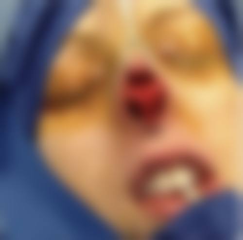 四、顺德艺美医疗美容特色项目
