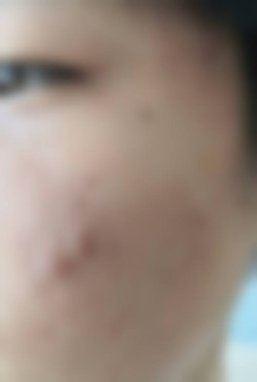 九、中山禾佳医疗美容真实的患者评价