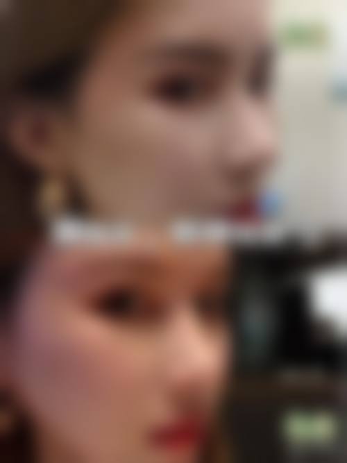 八、煕朵医疗美容植发连锁济南院部真实的患者评价