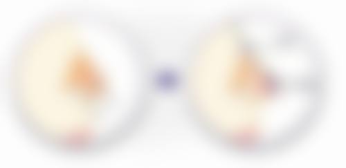 二、埋线双眼皮术后肿胀情况