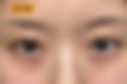 九、中山致妍医疗美容门诊部真实的患者评价