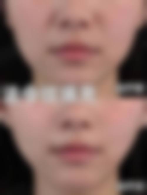 总结与预约号召