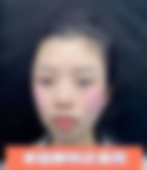 四、深圳星光会美医疗美容诊所特色项目
