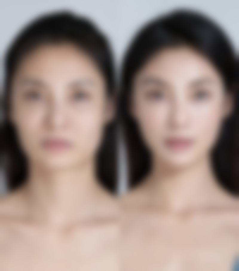 九、宁波宫主瑞丽斯医疗美容门诊部真实的患者评价