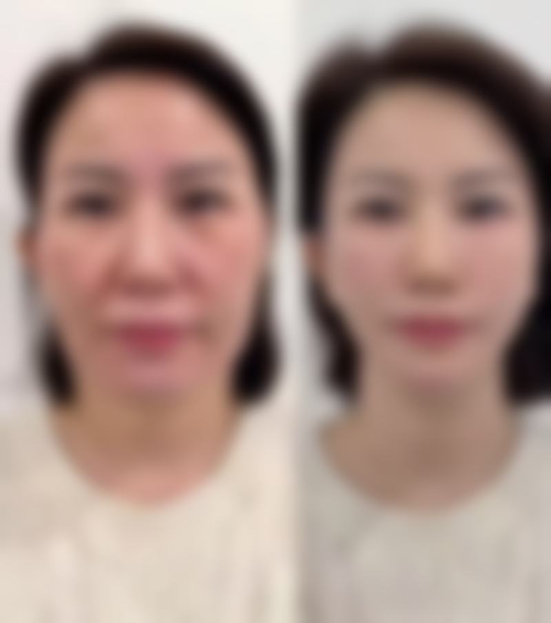 四、修复成效的评估