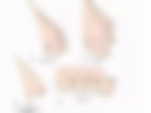 一、玻尿酸除皱能维持多长时间