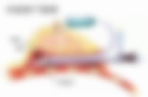 二、梦想打瘦脸针之是否适合注射