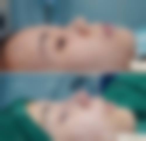 八、合肥诗蔓医疗美容门诊部预约方式