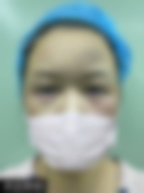 患者真实评价