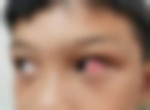 立即预约，重获清晰视界