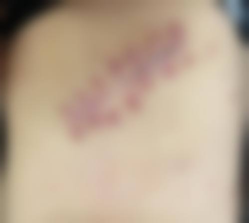 六、郭红磊真实的患者评价