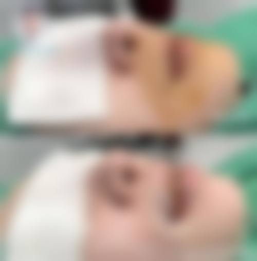八、襄阳百年整形医院真实的患者评价