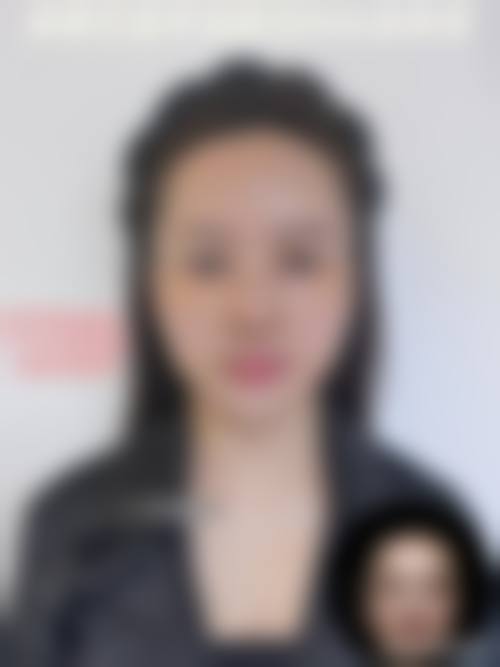 四、合肥诗蔓医疗美容门诊部特色项目