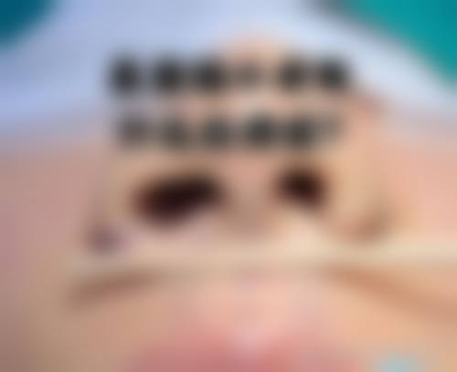八、长春熙颜整形医院真实的患者评价