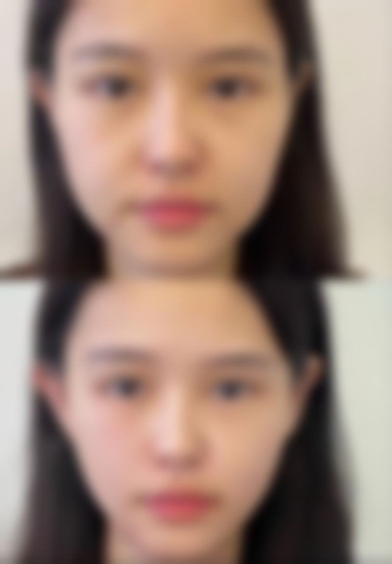 五、倪后继怎么预约？